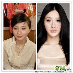 爆料女星削骨视频大全最新,女星削骨手术视频大盘点